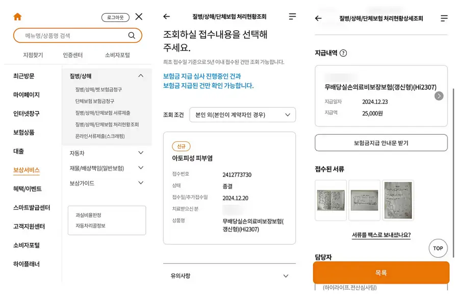 아토피연고-실비청구